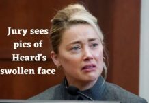 Jury sees pics of Heard's swollen face