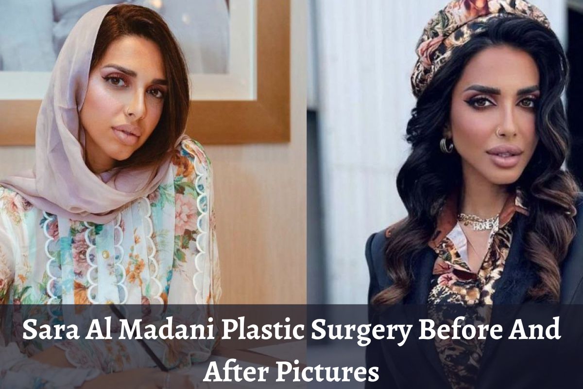 Sara Al Madani Plastic Surgery Before And After Pictures