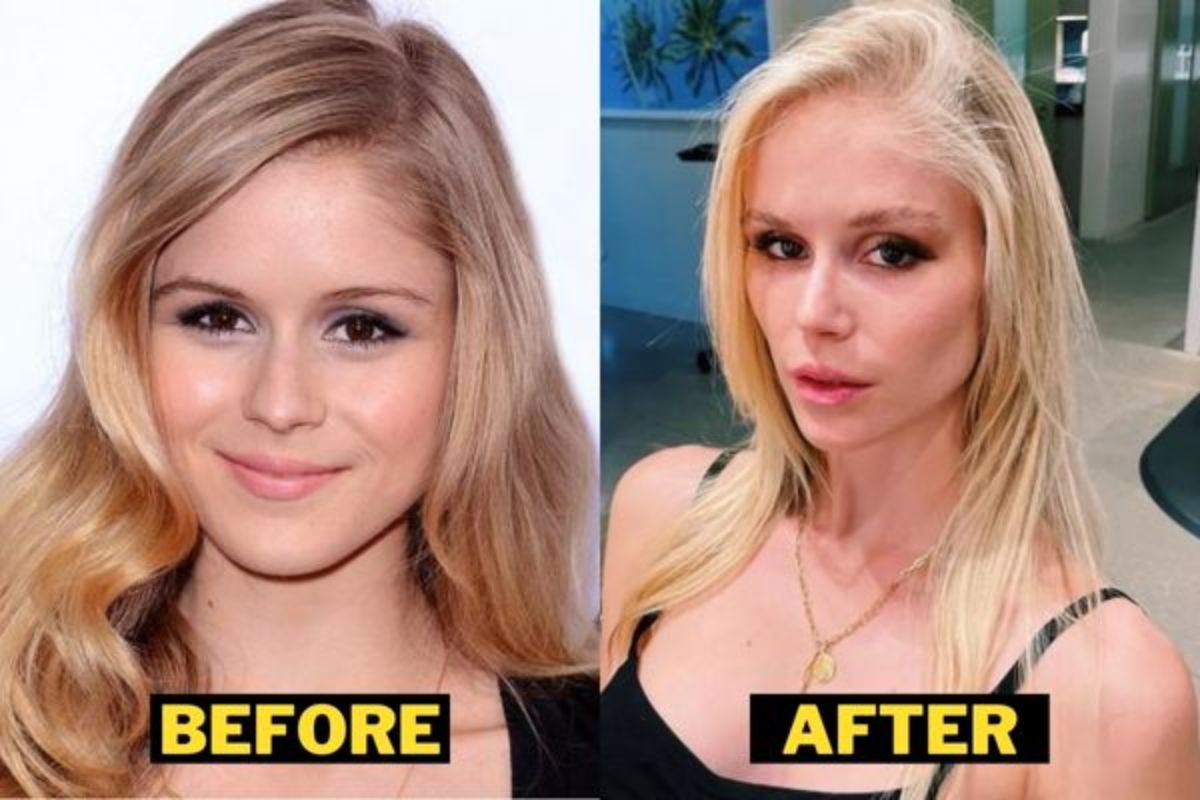 Did Erin Moriarty Get Plastic Surgery Done? Check Her Before and After Pics