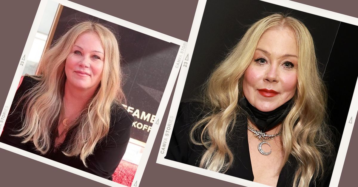 Christina Applegate Claims Plastic Surgery Changed Her Look