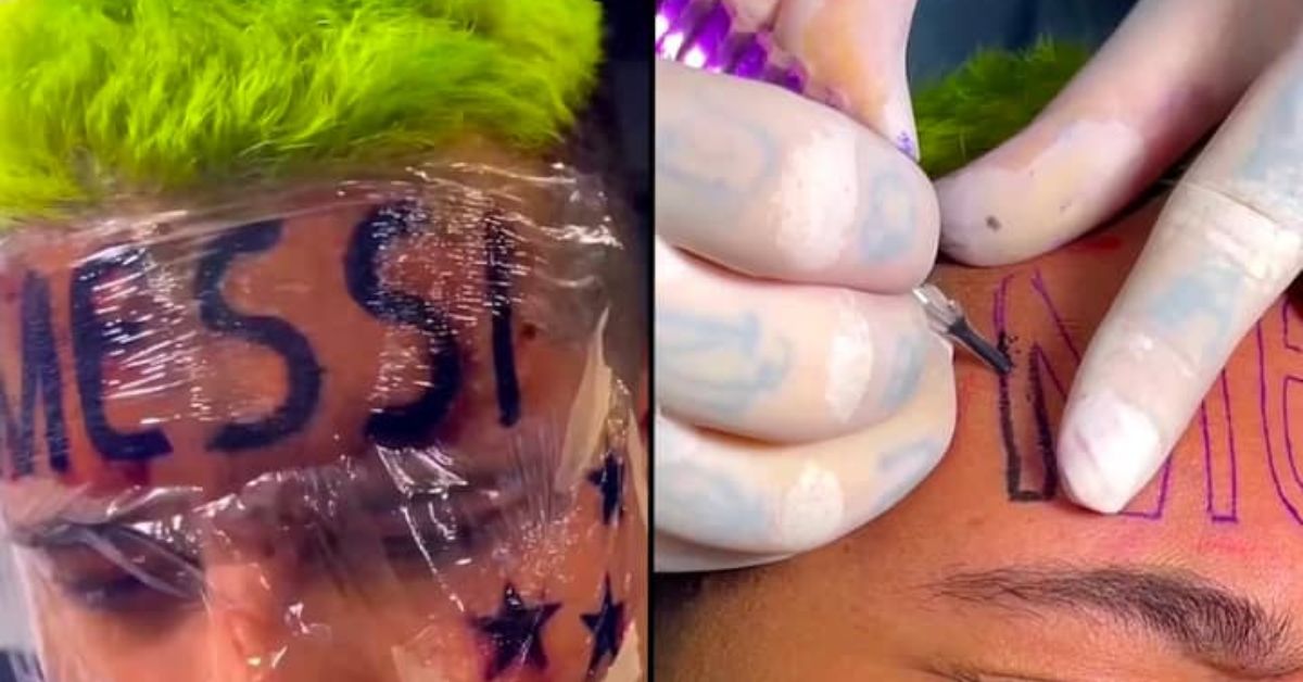 Fan Regrets Getting Lionel Messi's Name Tattooed On His Forehead