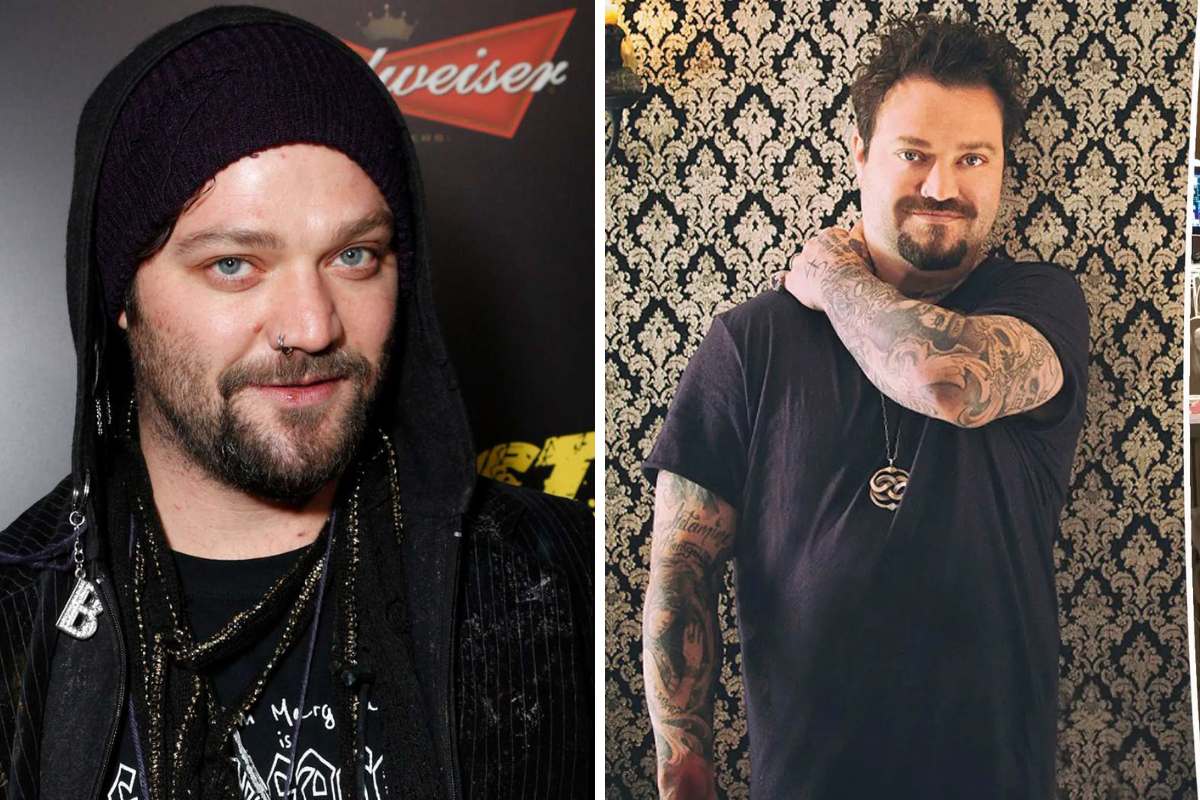 I Was Pronounced Dead Bam Margera Reveals After Suffering Five Seizures