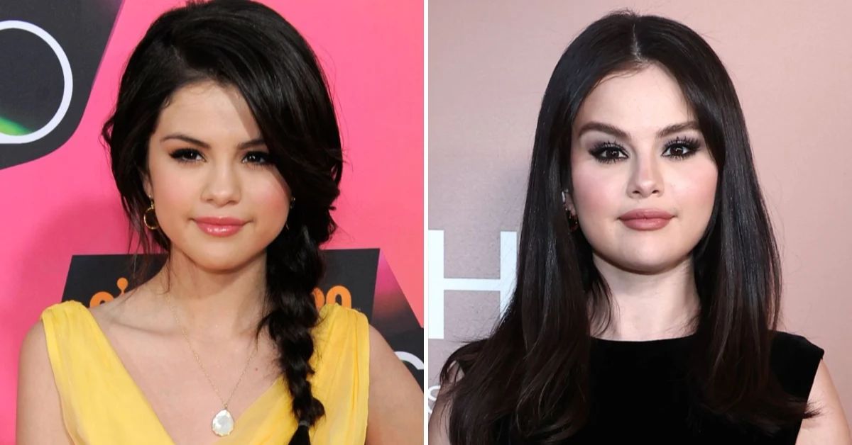 Selena Gomez cat eye surgery