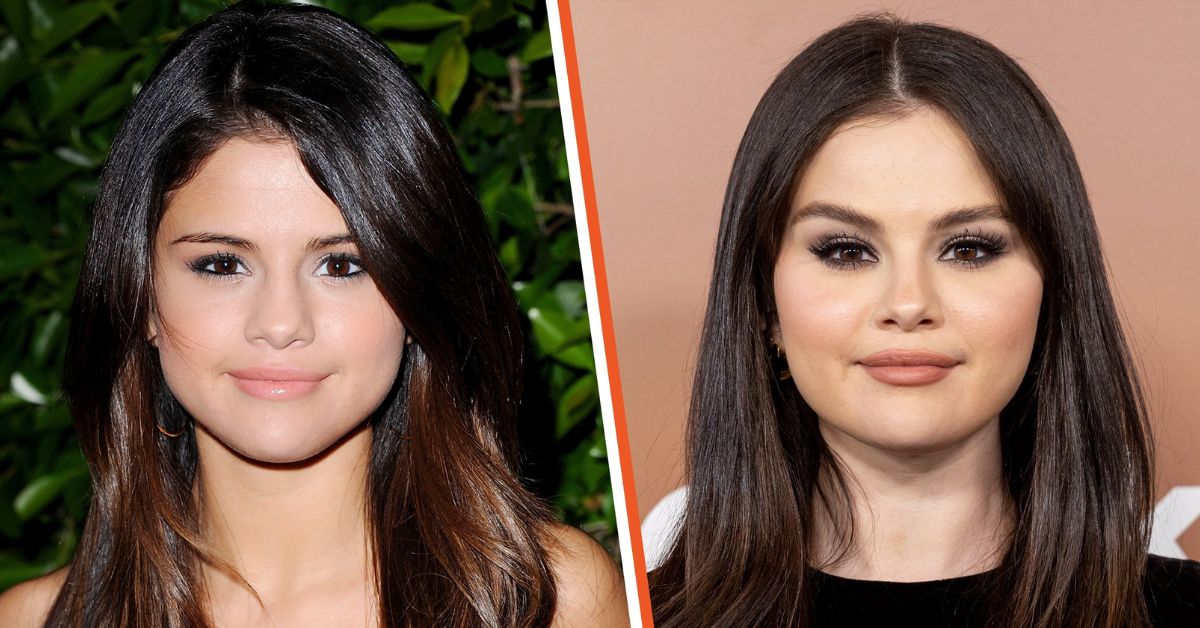 Selena Gomez cat eye surgery