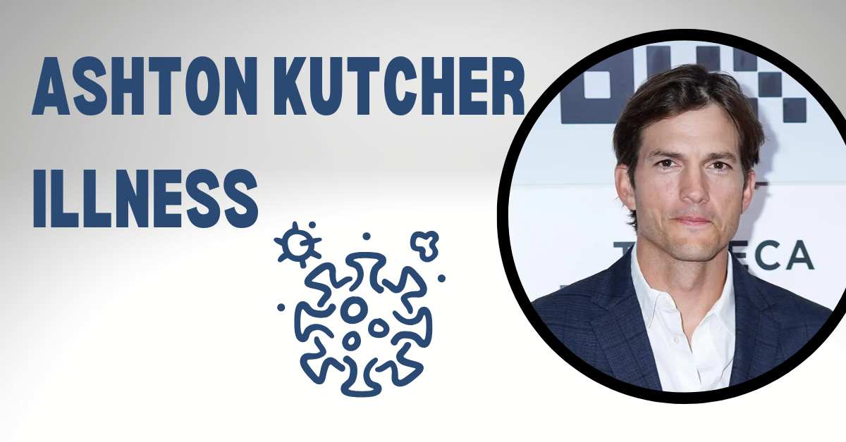 Ashton Kutcher Illness