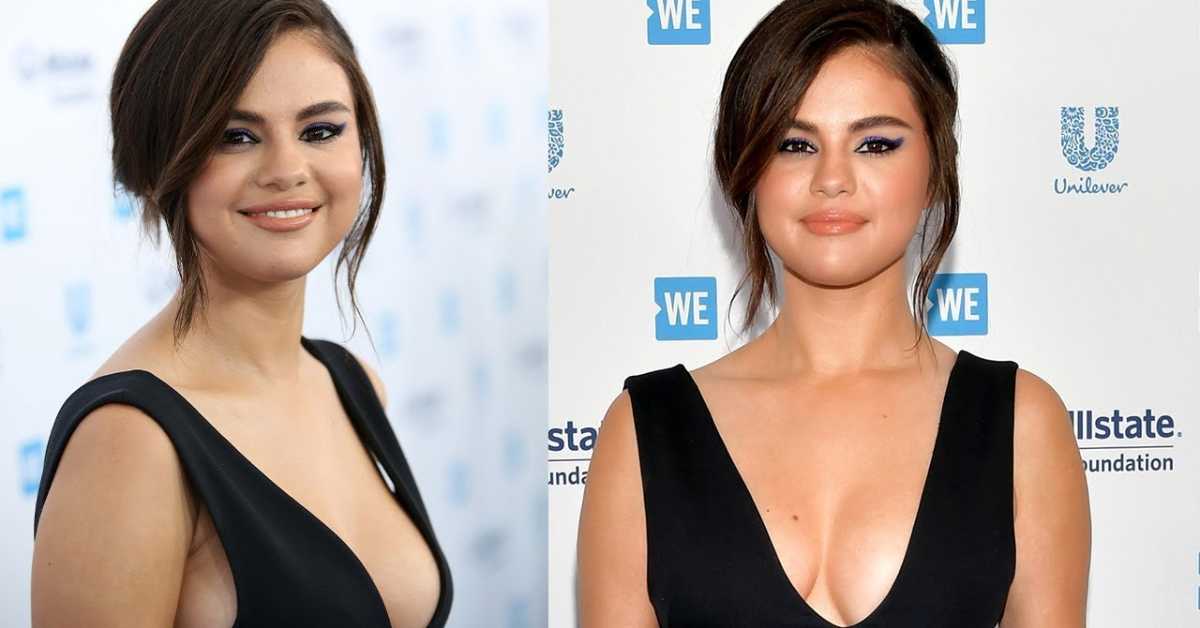 Did Selena Gomez Get Breast Implants