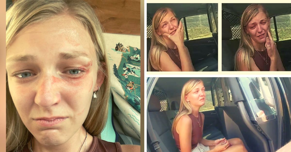 Gabby Petito Injury Photos Show the Reality of Utah Domestic Abuse