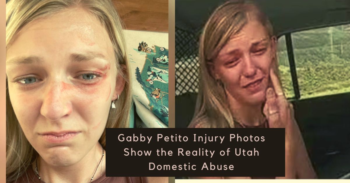 Gabby Petito Injury Photos Show the Reality of Utah Domestic Abuse