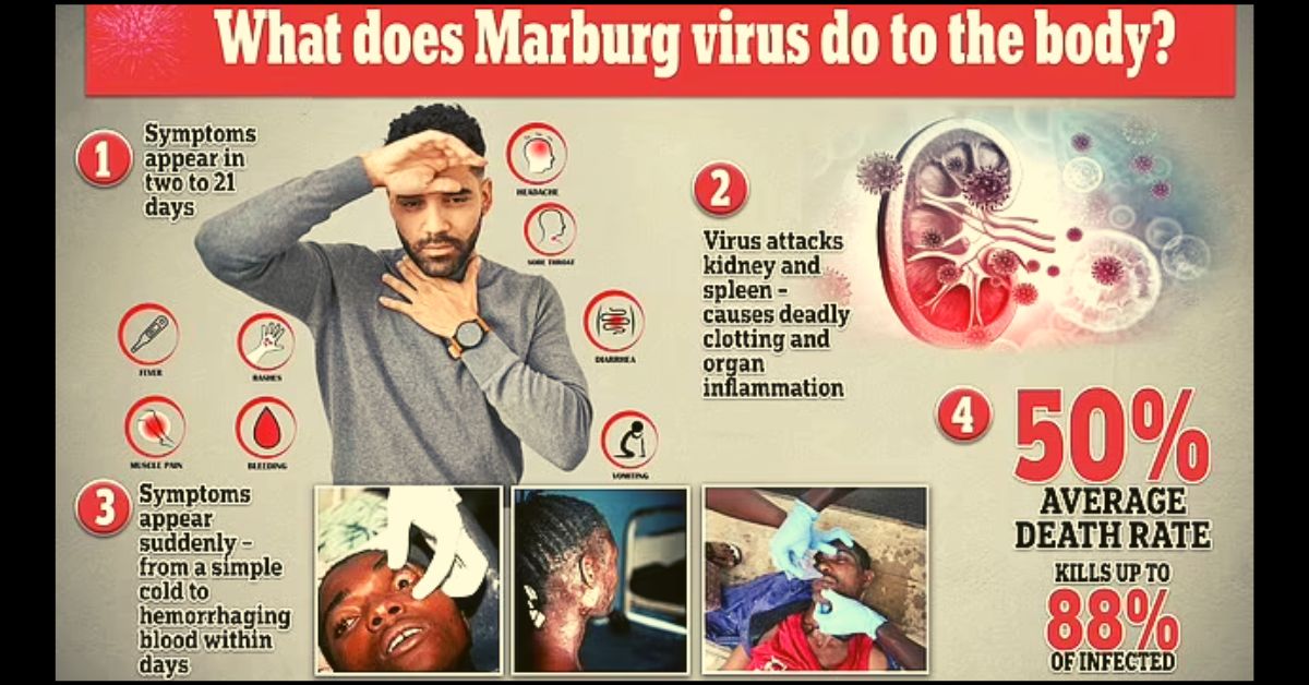 Is Marburg Virus a Real Danger