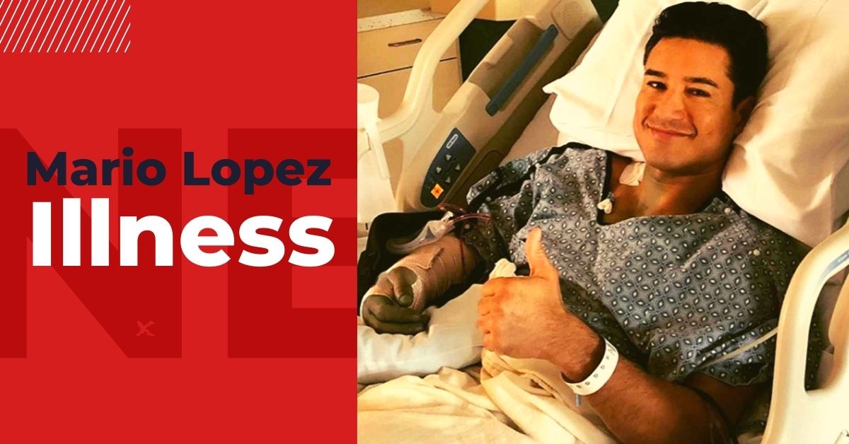 Mario Lopez Illness