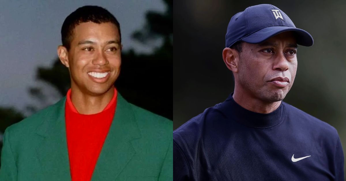 Tiger Woods Plastic Surgery