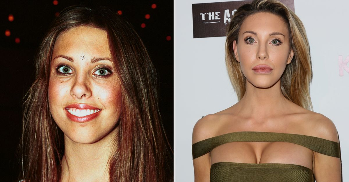 Chloe Lattanzi Plastic Surgery: What Has She Done to Her Face?