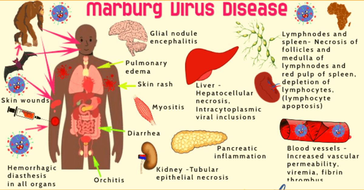 What is the Marburg Virus