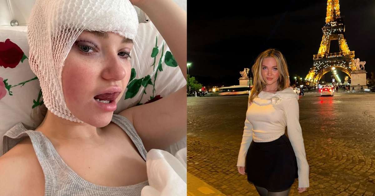 Alyssa Mckay Plastic Surgery Viral On Tiktok Before And After Photo