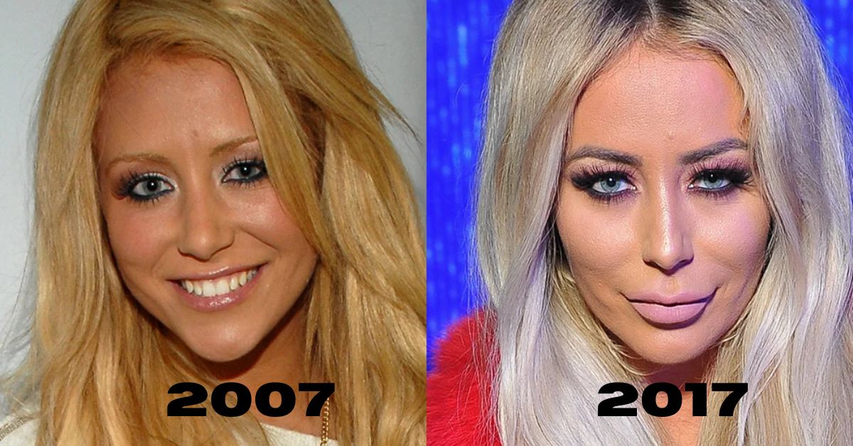 Aubrey O’Day Before And After 