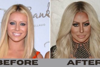 Aubrey O’Day Before And After