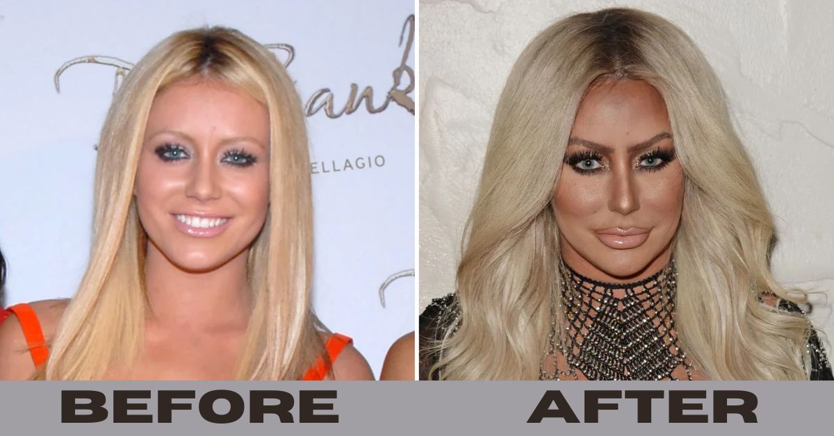 Aubrey O’Day Before And After