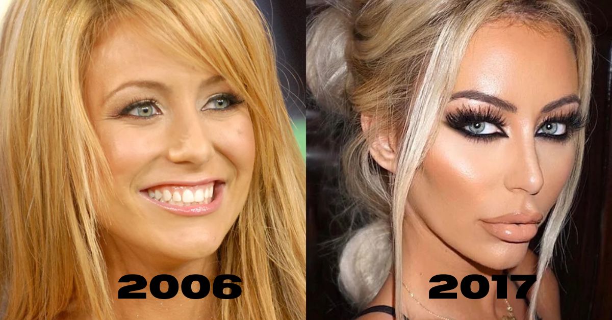 Aubrey O’Day Before And After 