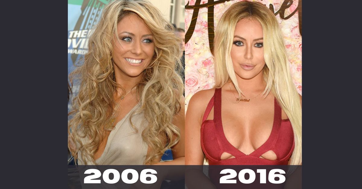 Aubrey O’Day Before And After 