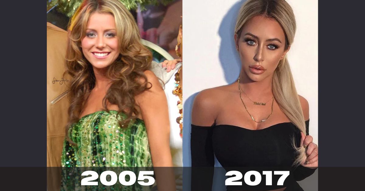 Aubrey O’Day Before And After 