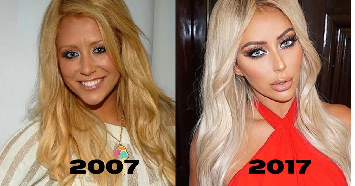 Aubrey O’Day Before And After