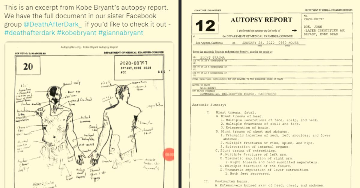 Kobe Bryant Autopsy Photo 