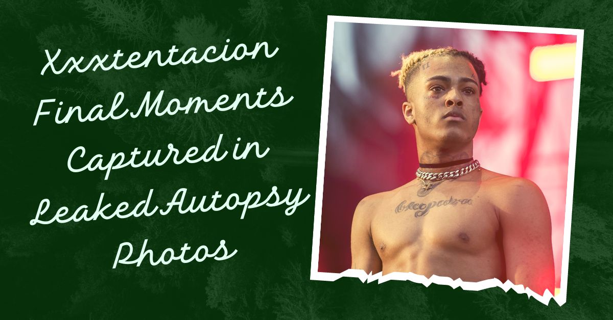 Xxxtentacion Autopsy Leak