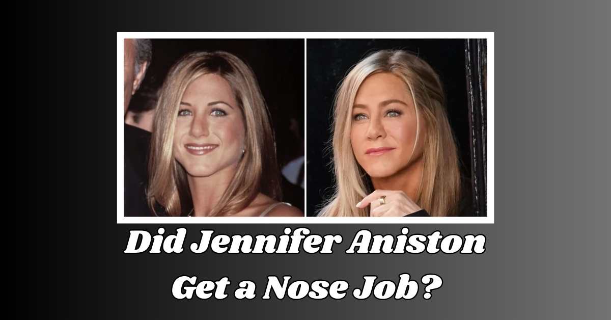 Did Jennifer Aniston Get a Nose Job