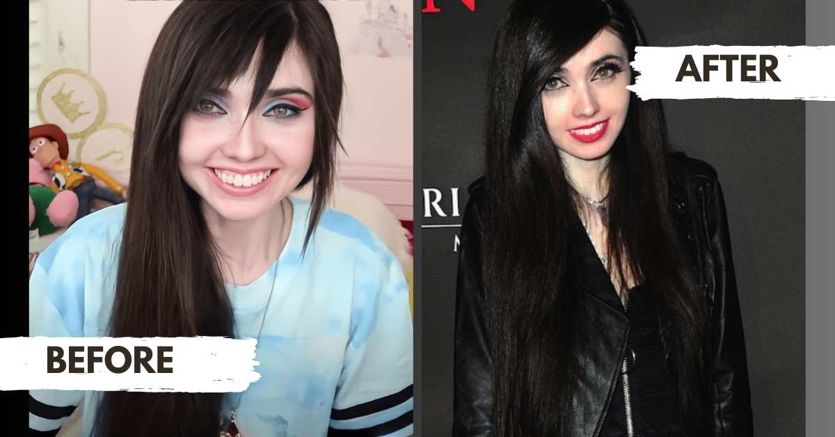 Eugenia Cooney Before and After Transformation