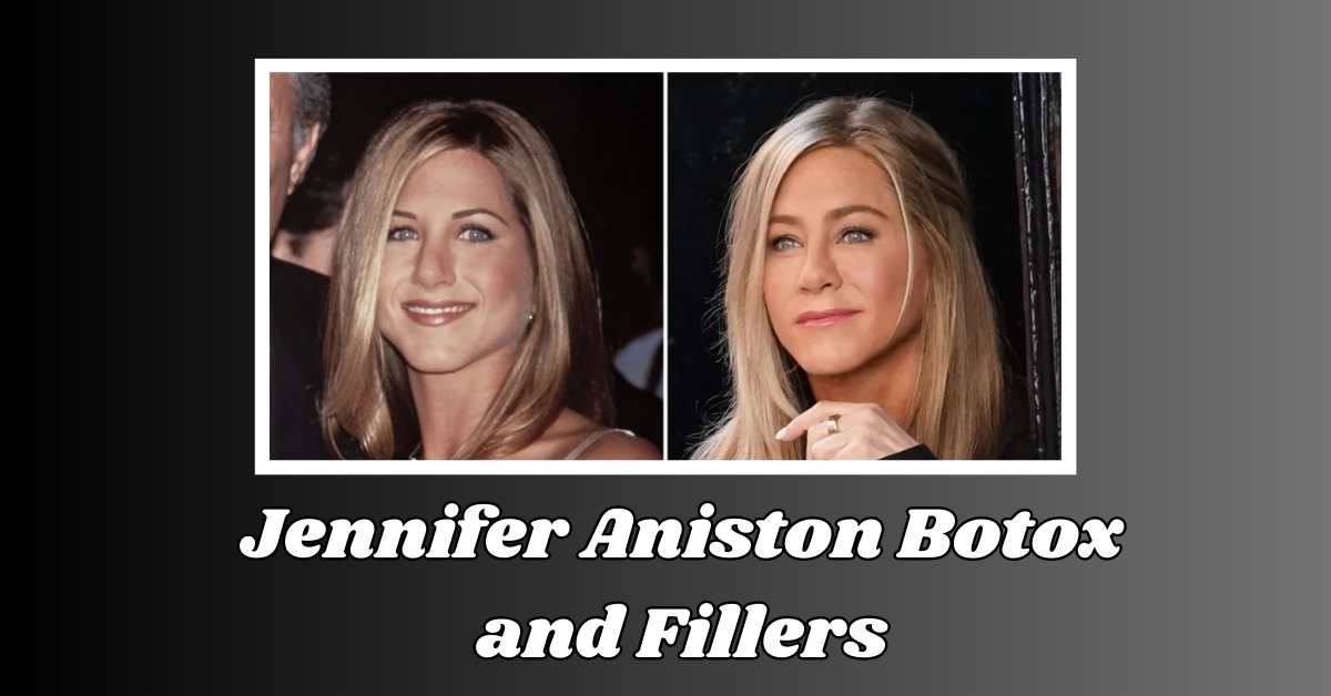 Jennifer Aniston Botox and Fillers