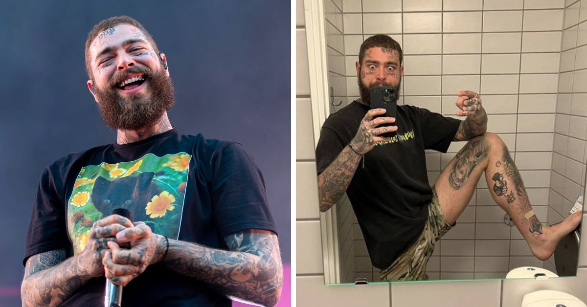 Post Malone Weight Loss