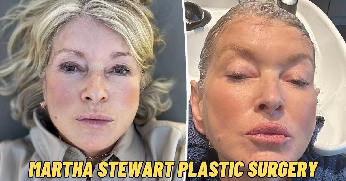 Martha Stewart Plastic Surgery