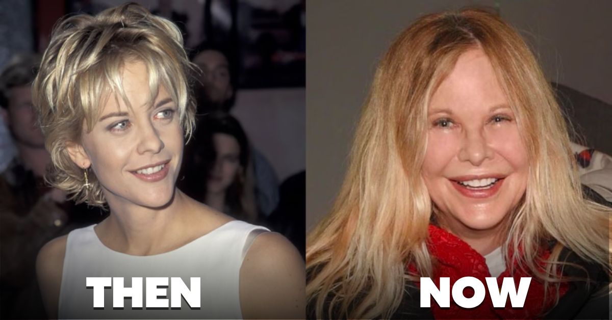 Meg Ryan Before And After Plastic Surgery The Secret Behind Actress