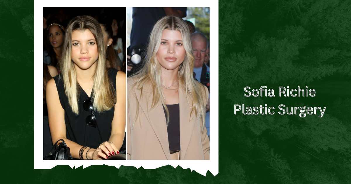 Sofia Richie Plastic Surgery