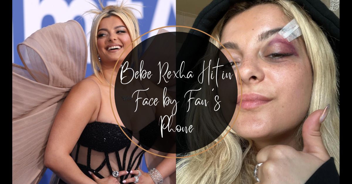 Bebe Rexha Hit in Face by Fan's Phone