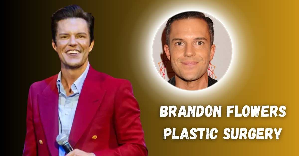 Brandon Flowers Plastic Surgery