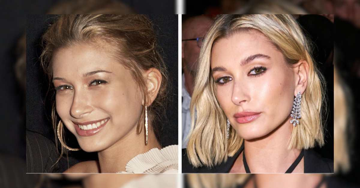 Hailey Bieber Before and After