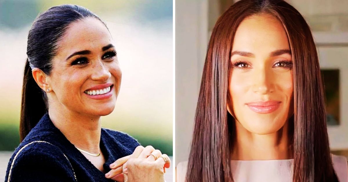 Meghan Markle Plastic Surgery