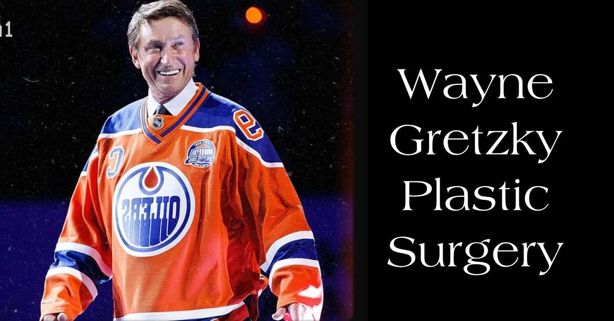 Wayne Gretzky Plastic Surgery: Assessing the Possible Facelift and Botox Procedures