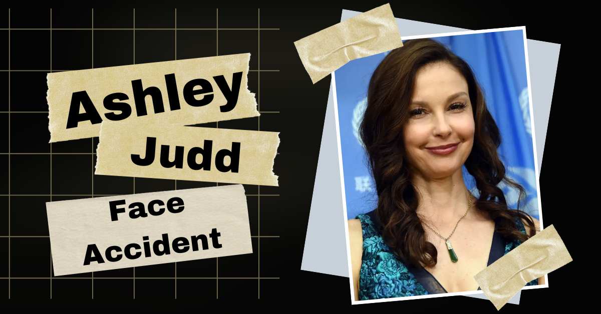 Ashley Judd Face Accident