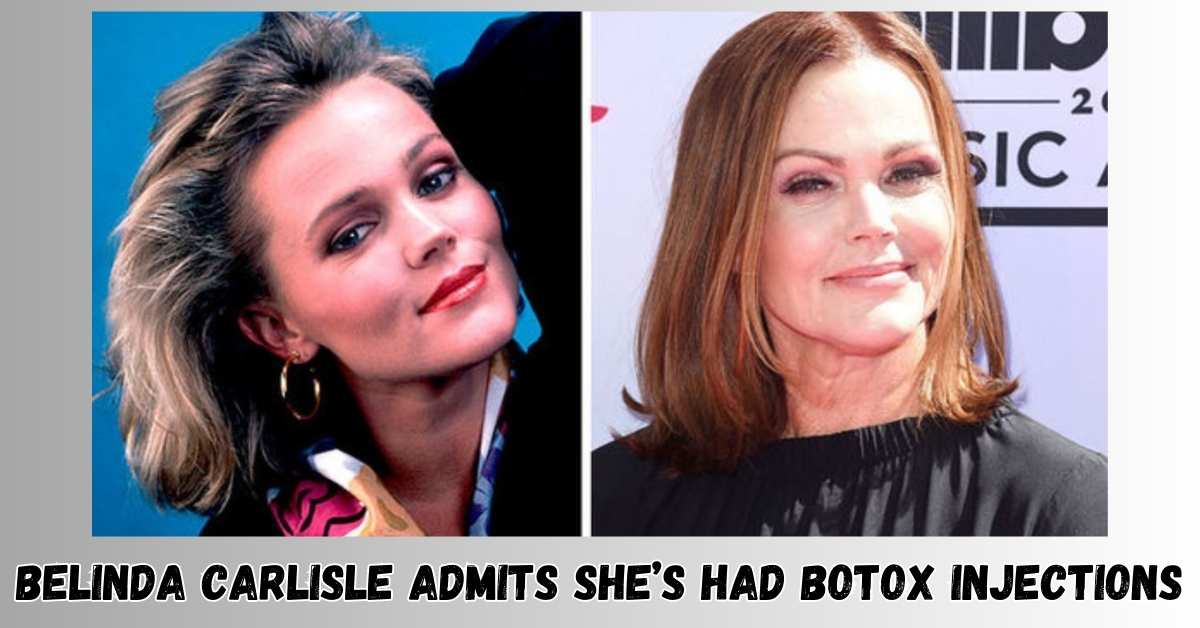 Belinda Carlisle Admits She’s Had Botox Injections