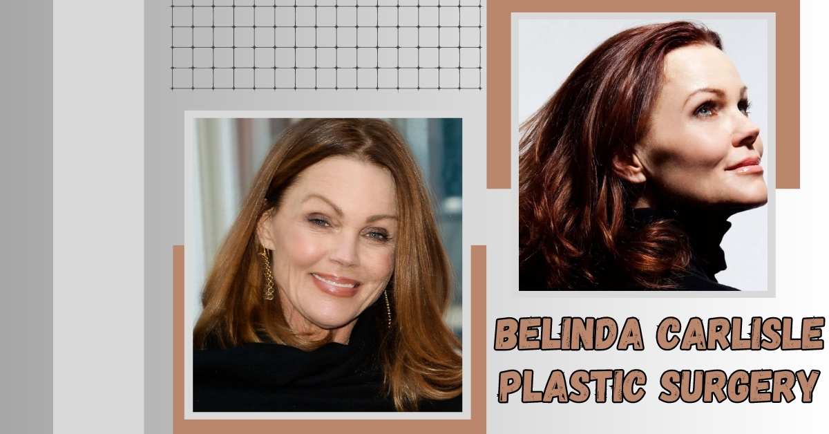 Belinda Carlisle Plastic Surgery