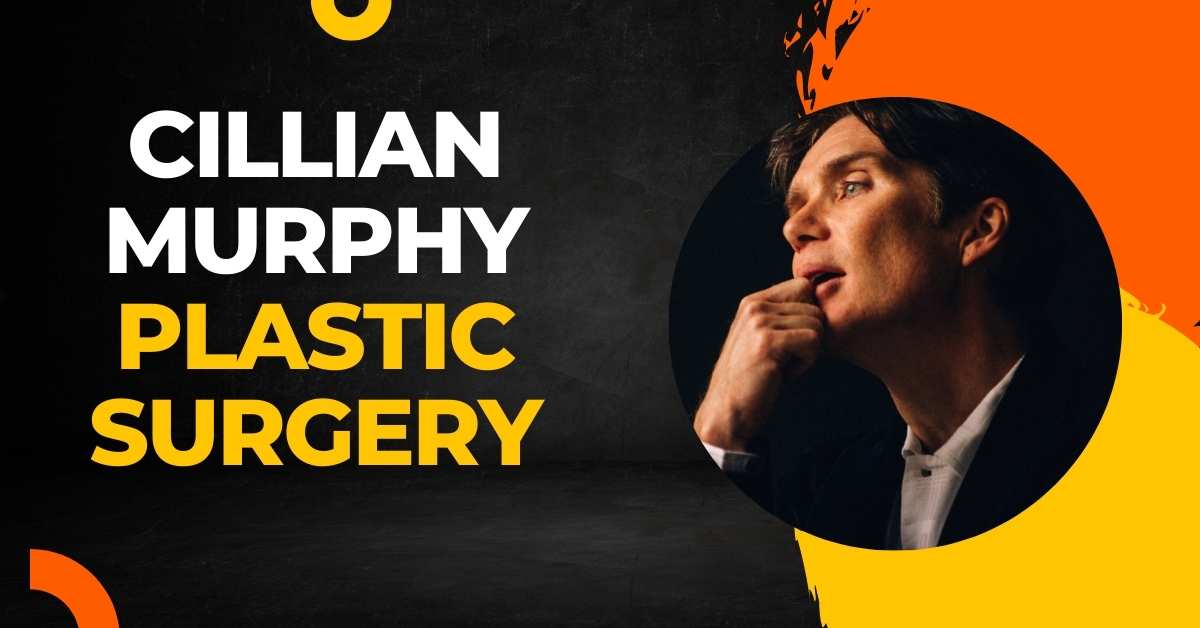 Cillian Murphy Plastic Surgery