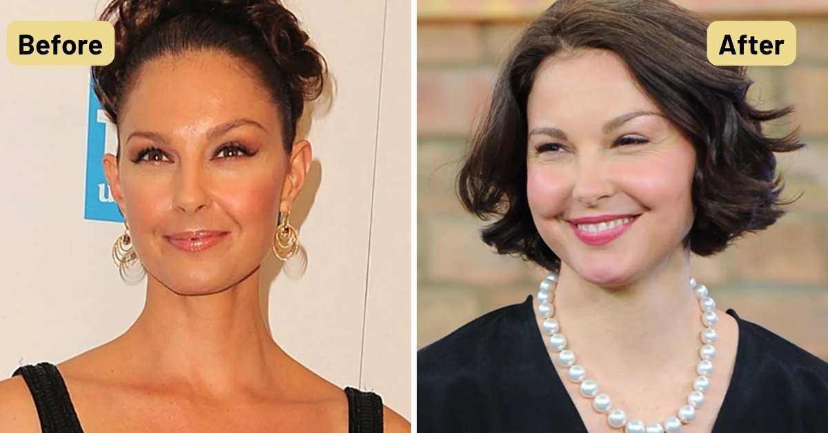 Comparing Ashley Judd's Face Before and After