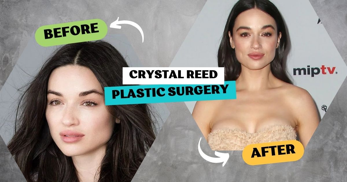 Crystal Reed Plastic Surgery