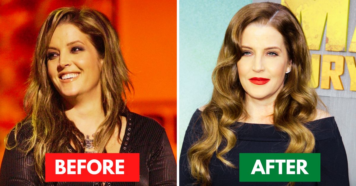 Did Lisa Marie Presley Have a Plastic Surgery?