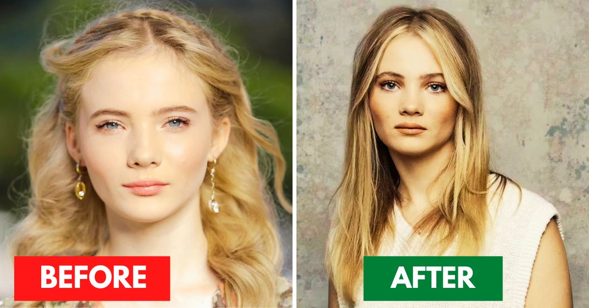 Freya Allen Plastic Surgery