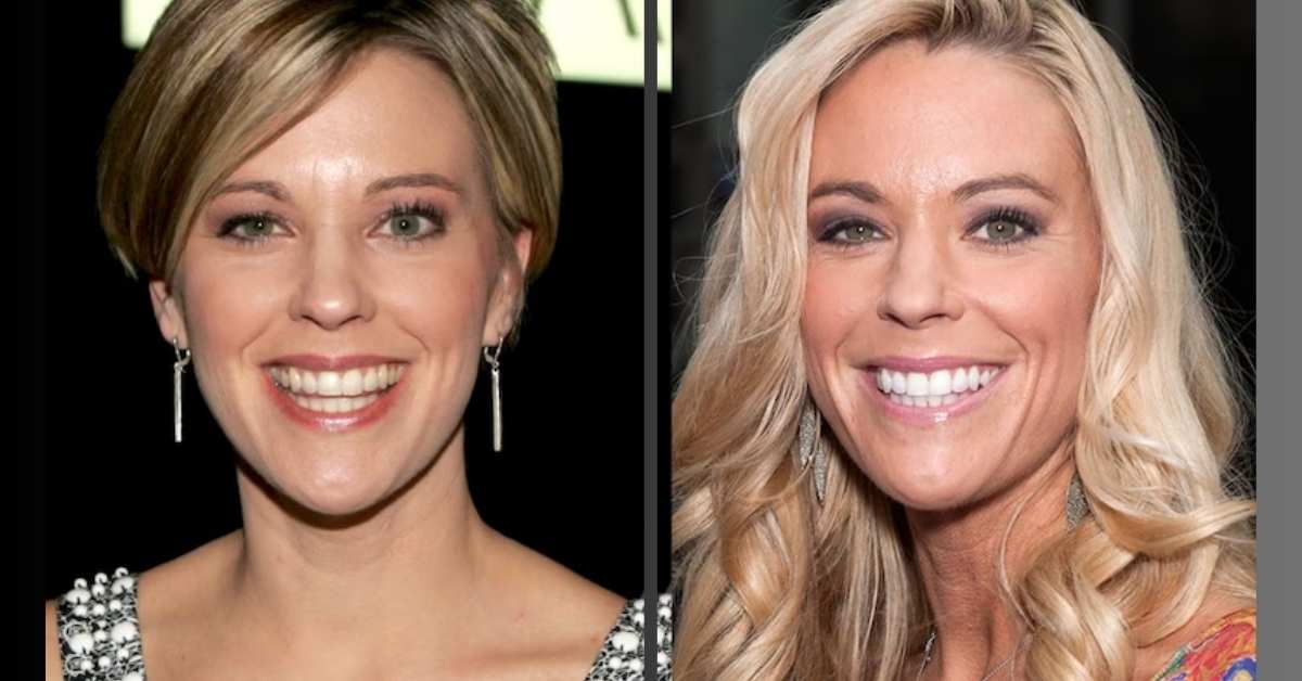 Kate Gosselin Plastic Surgery Before and After