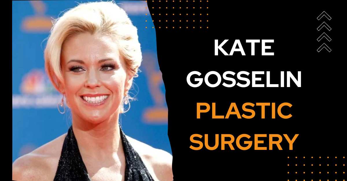 Kate Gosselin Plastic Surgery