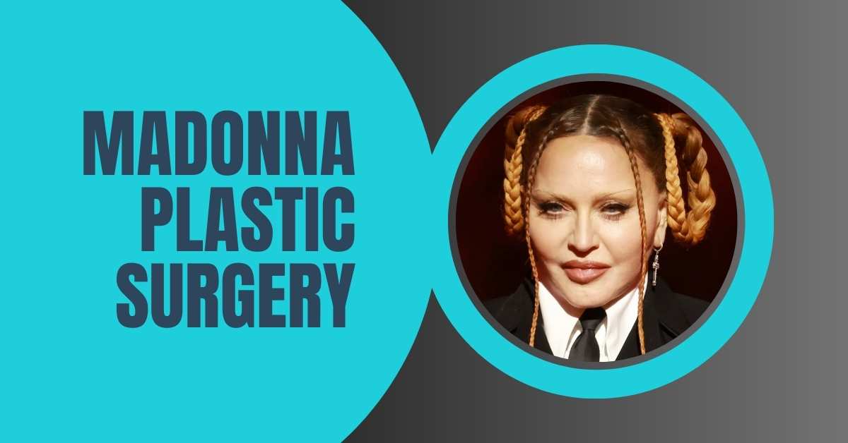 Madonna Plastic Surgery